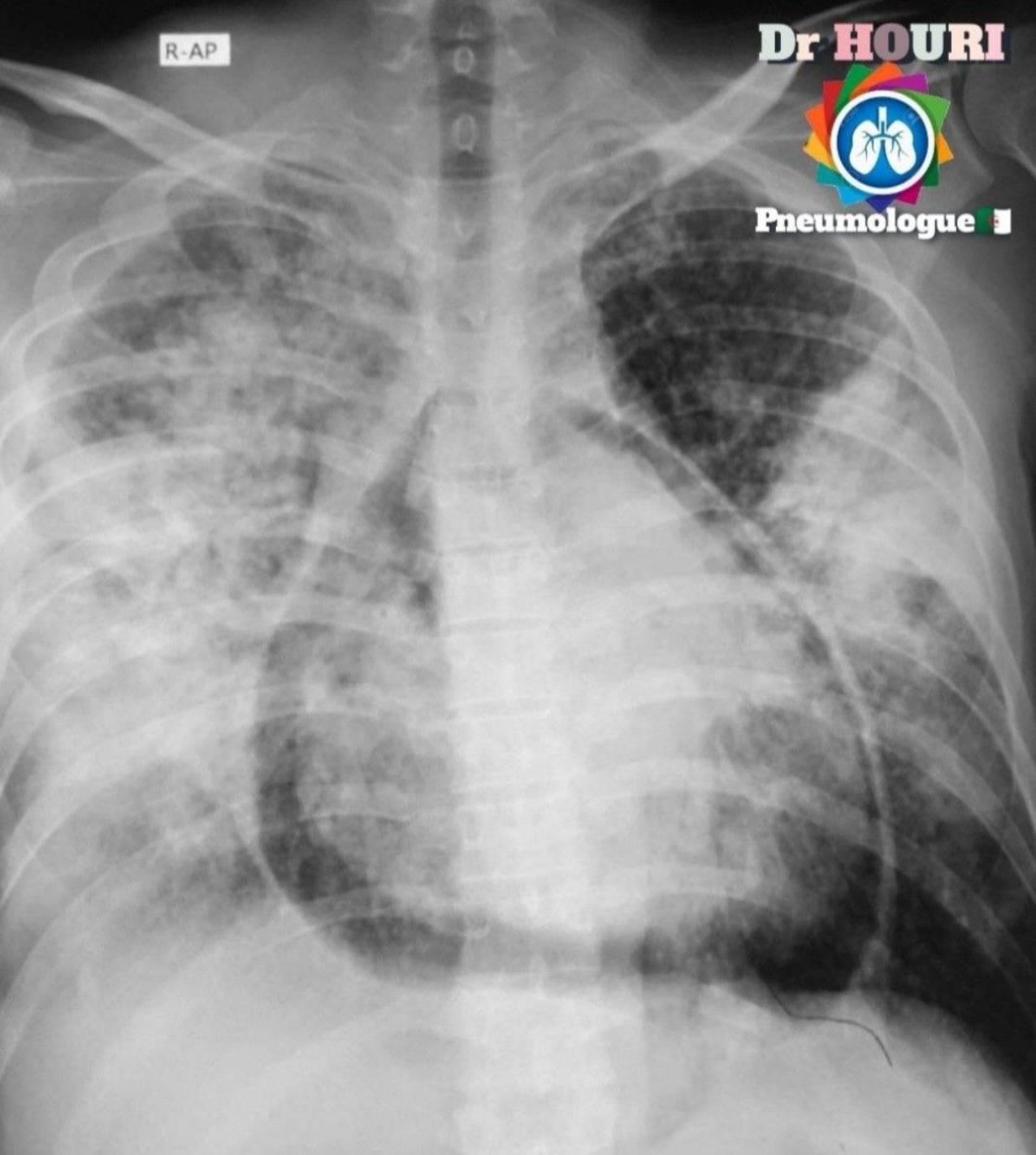 Radiologie 88