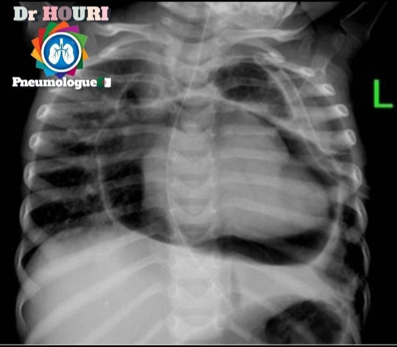 Radiologie 89