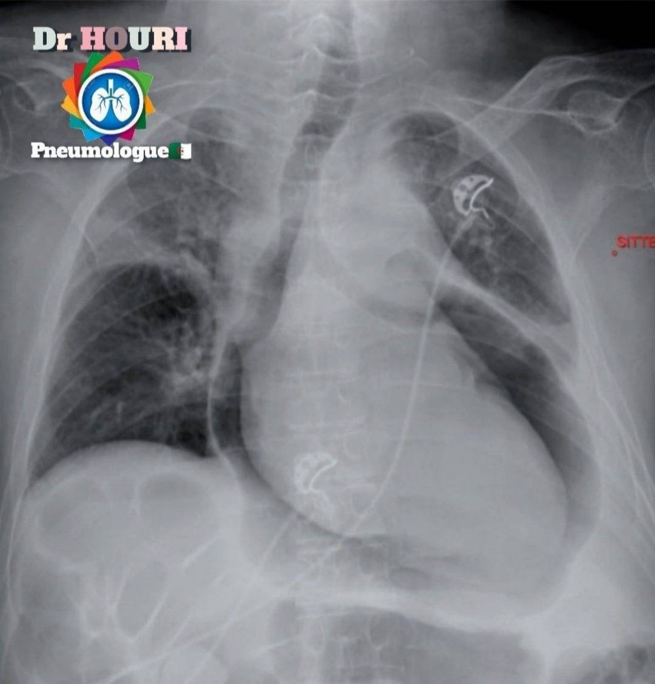 Radiologie 90