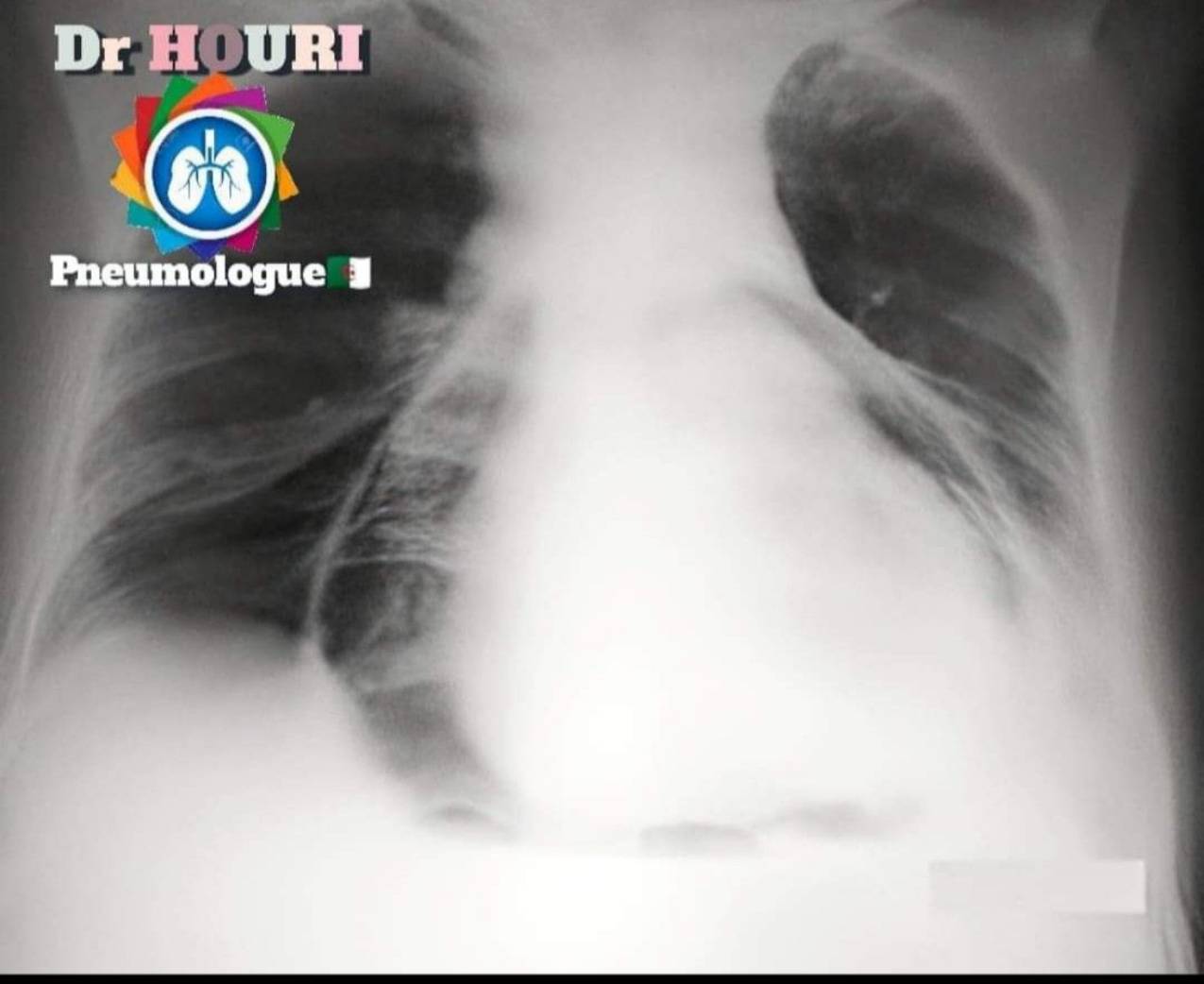 Radiologie 91