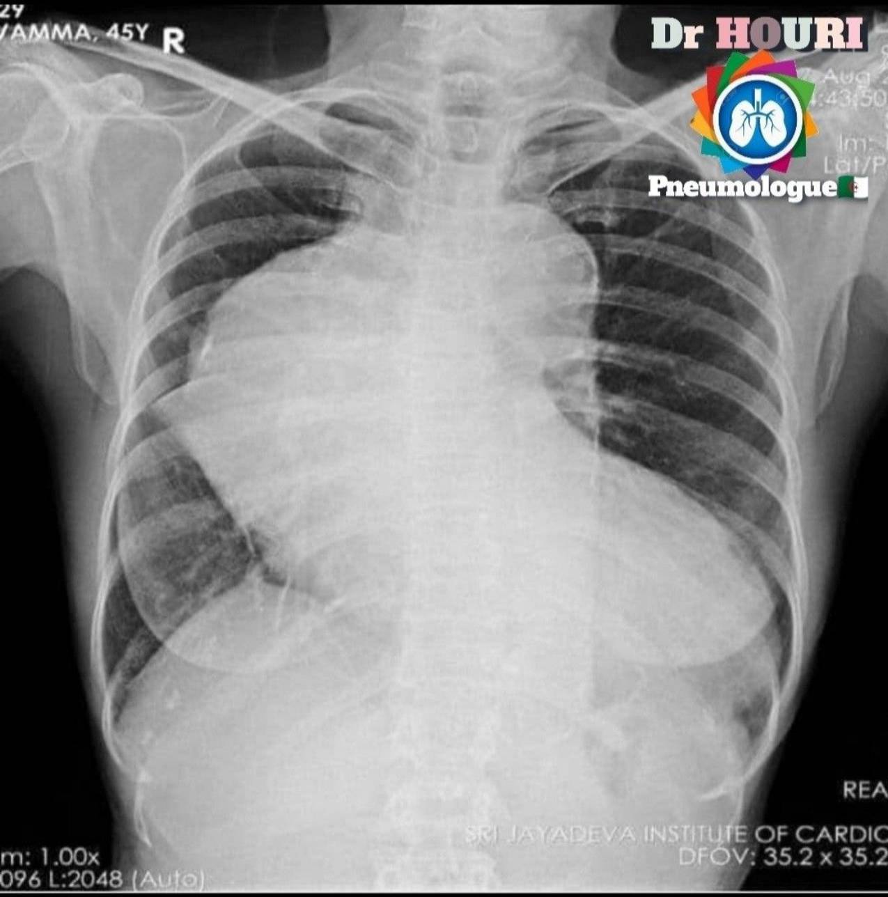 Radiologie 95