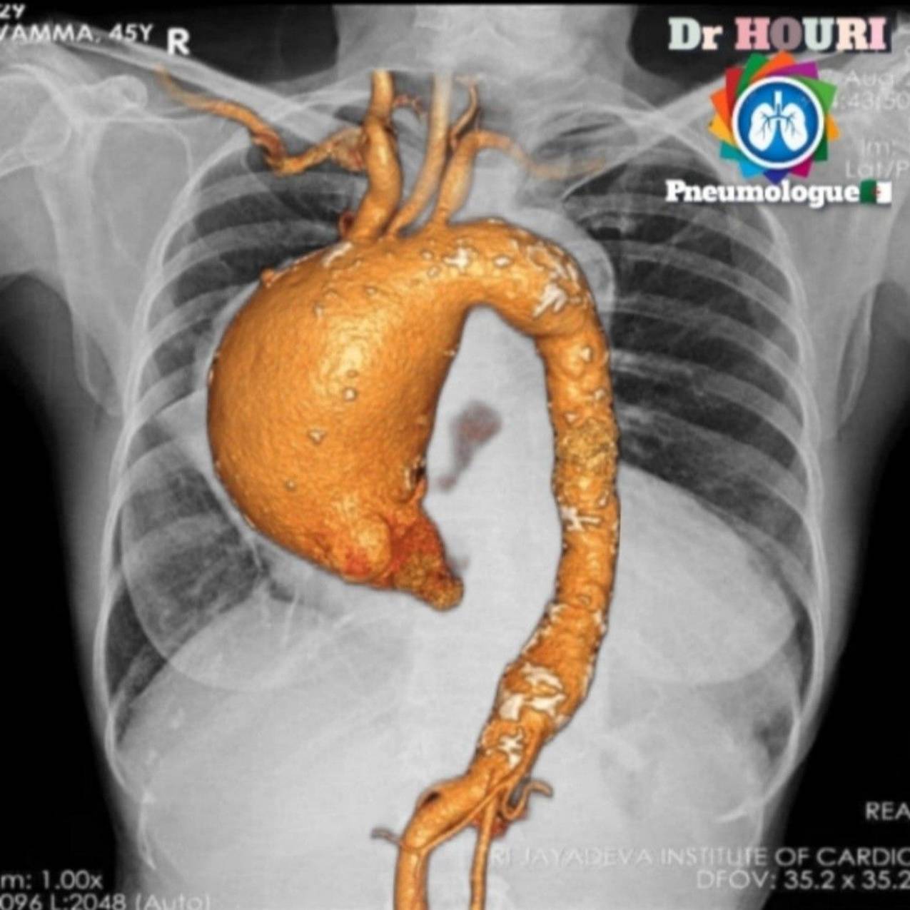 Radiologie 96