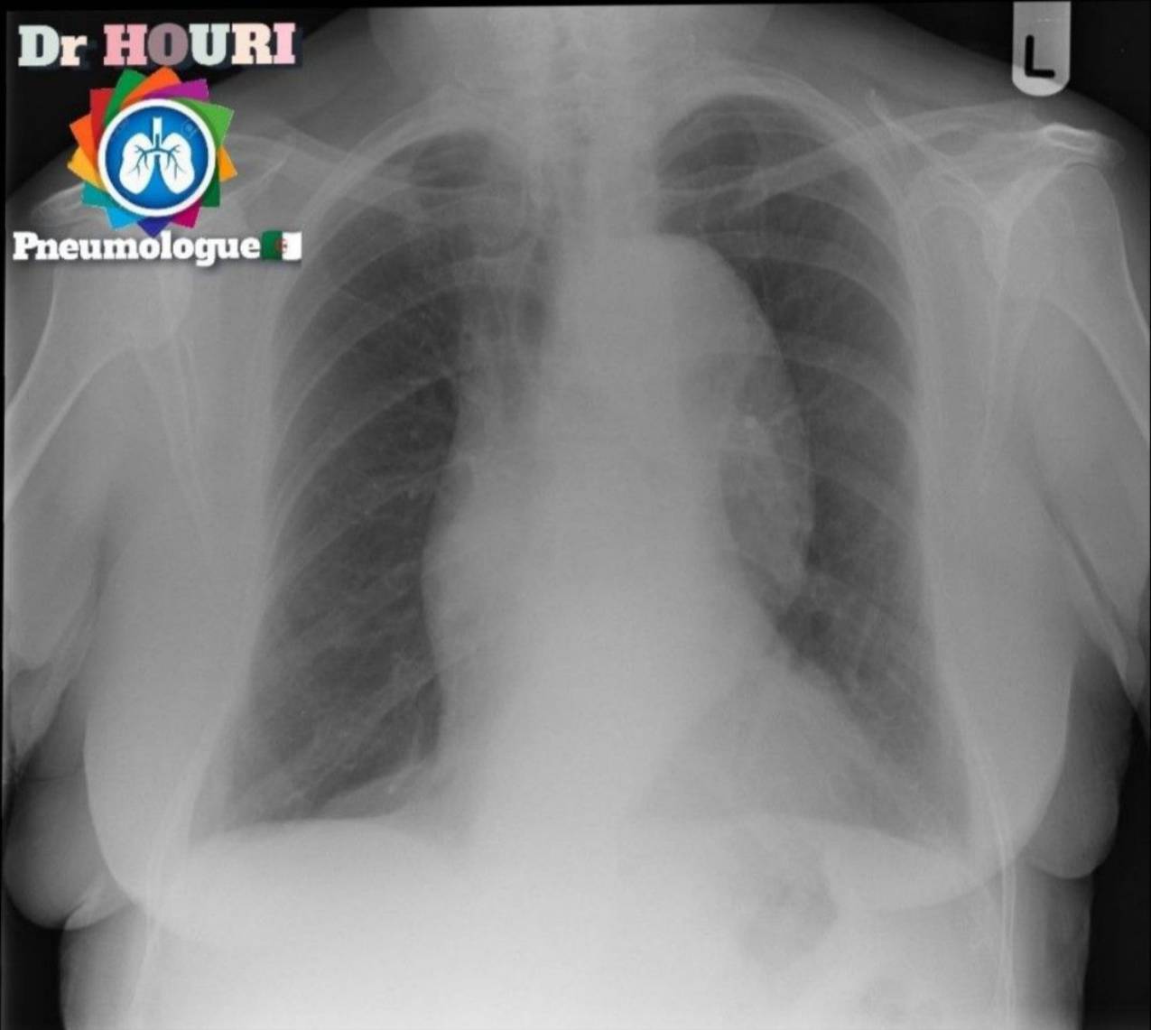 Radiologie 97