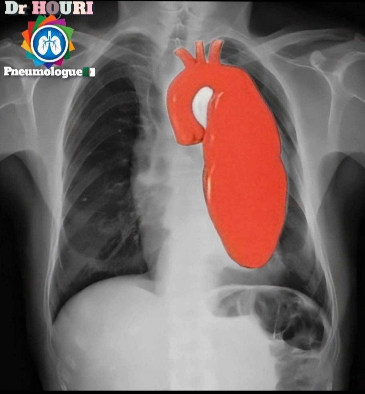 Radiologie 99