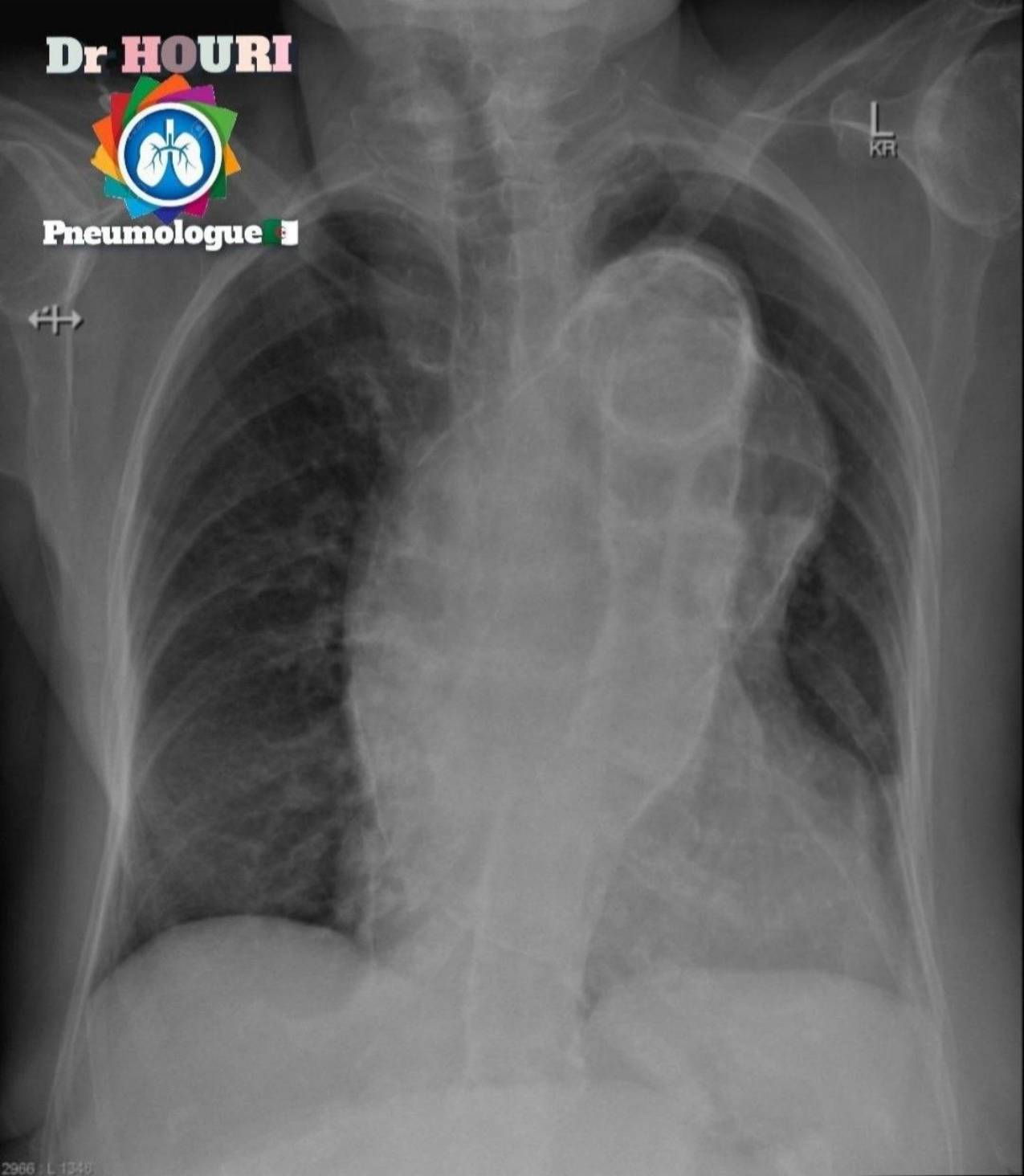 Radiologie 100