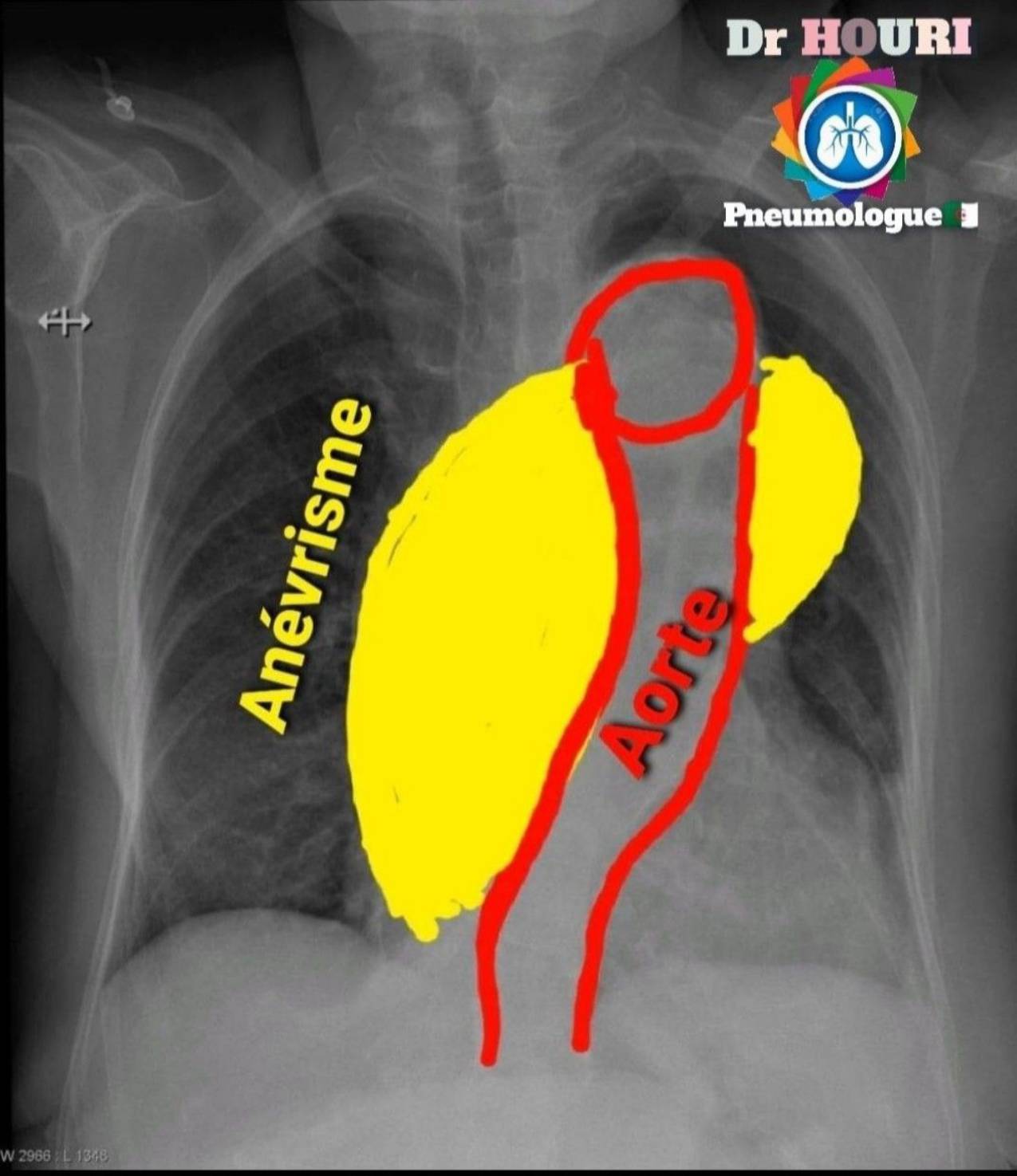 Radiologie 101
