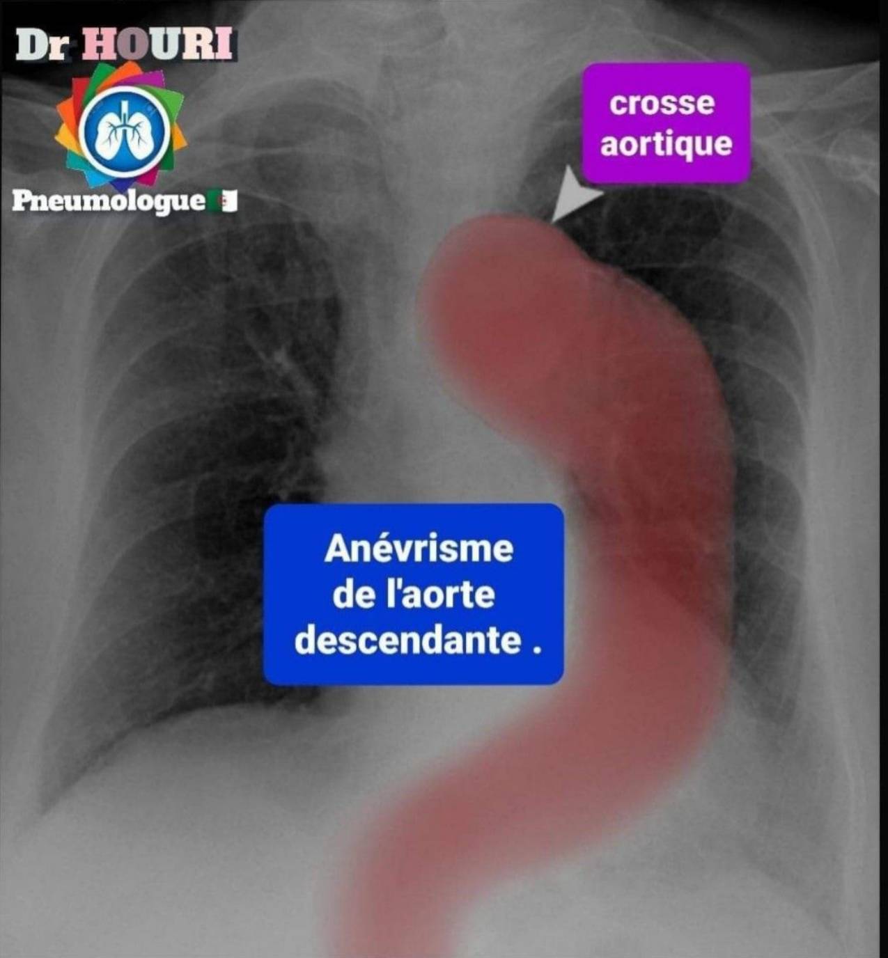 Radiologie 103