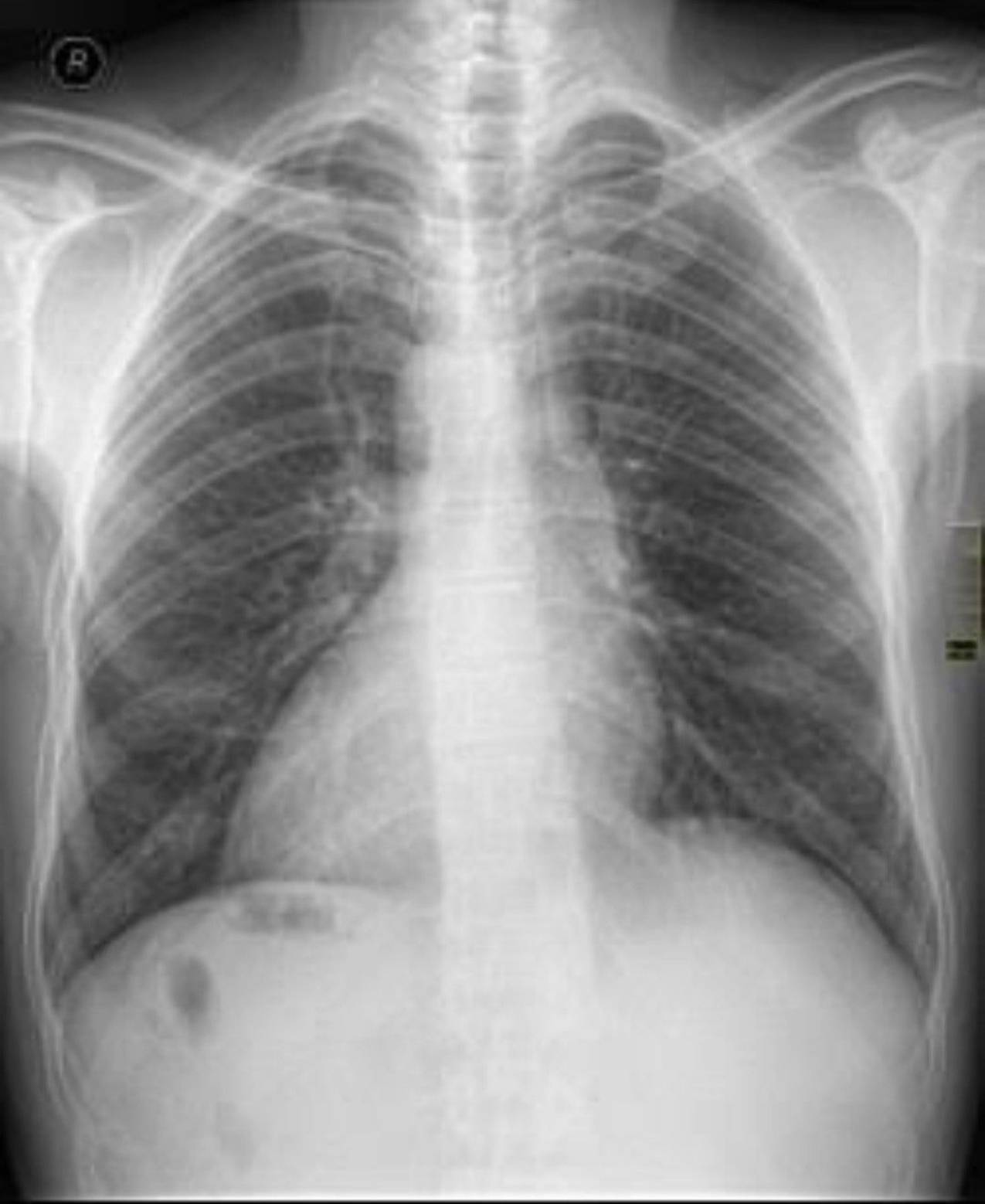 Radiologie 106