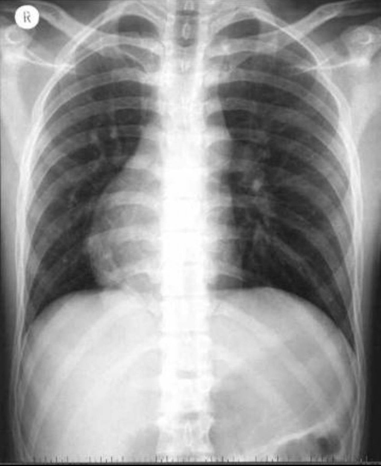 Radiologie 107