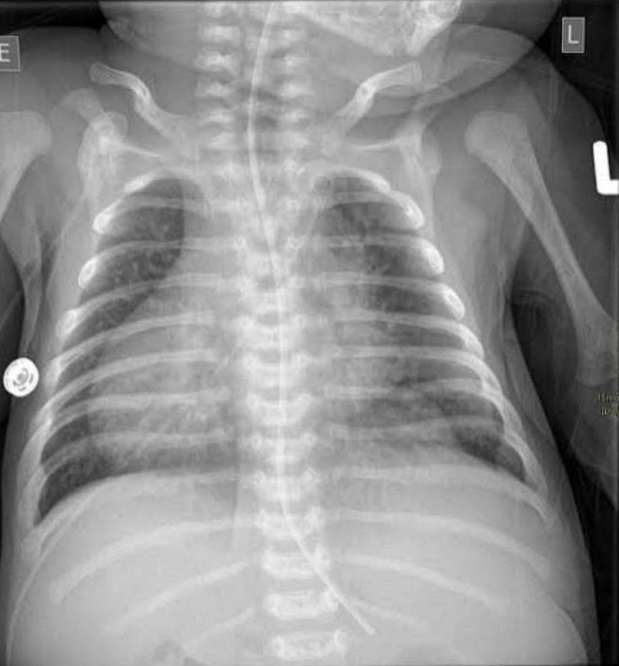 Radiologie 108