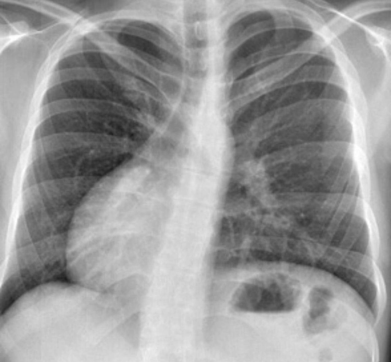 Radiologie 109