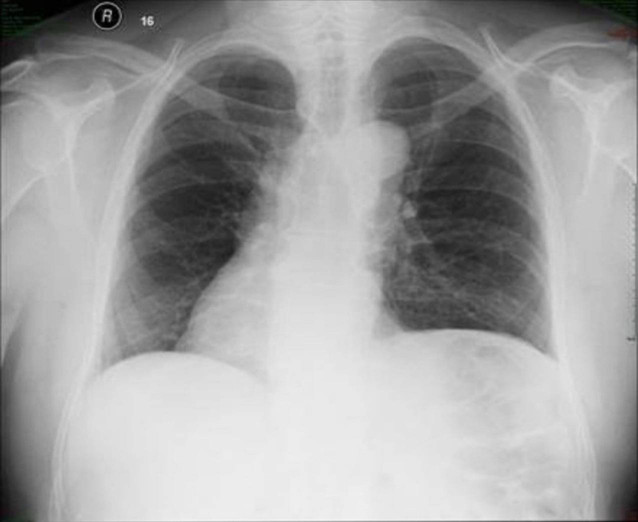 Radiologie 110